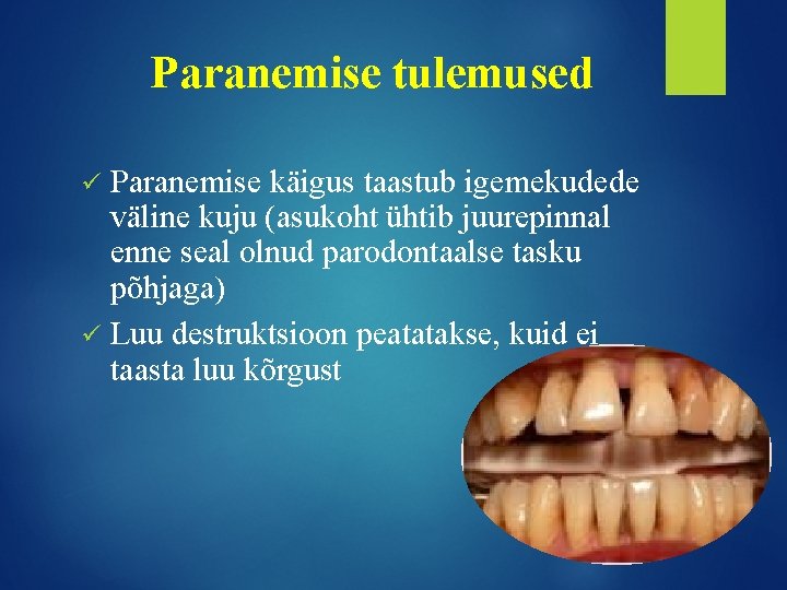 Paranemise tulemused Paranemise käigus taastub igemekudede väline kuju (asukoht ühtib juurepinnal enne seal olnud