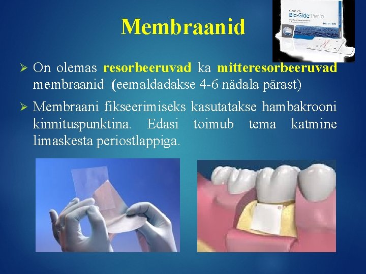 Membraanid Ø On olemas resorbeeruvad ka mitteresorbeeruvad membraanid (eemaldadakse 4 -6 nädala pärast) Ø