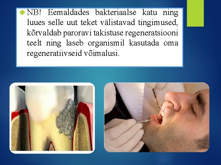 NB! Eemaldades bakteriaalse katu ning luues selle uut teket välistavad tingimused, kõrvaldab paroravi NB! Eemaldades bakteriaalse katu ning luues selle uut teket välistavad tingimused, kõrvaldab paroravi