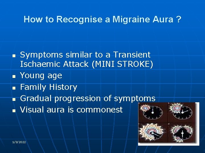 How to Recognise a Migraine Aura ? n n n Symptoms similar to a