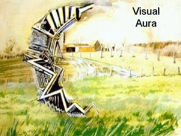 Visual Aura 1/3/2022 21 