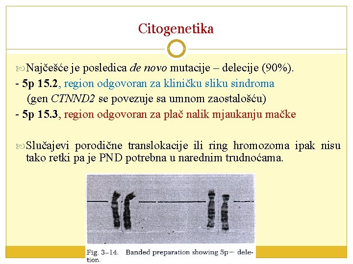 Citogenetika Najčešće je posledica de novo mutacije – delecije (90%). - 5 p 15.