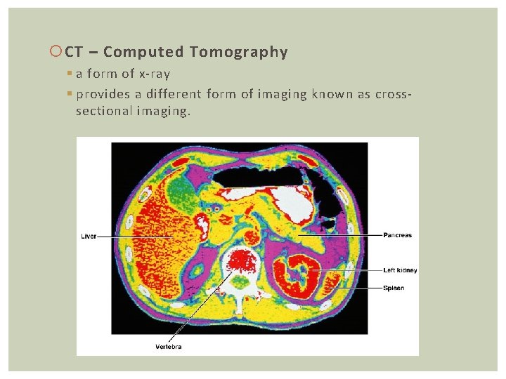  CT – Computed Tomography § a form of x-ray § provides a different