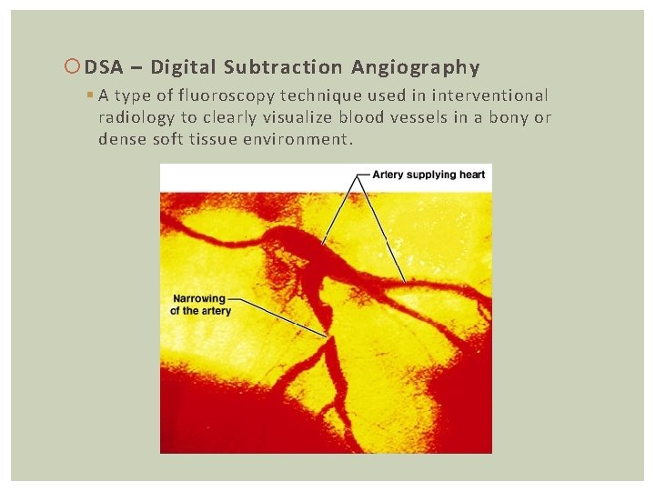  DSA – Digital Subtraction Angiography § A type of fluoroscopy technique used in