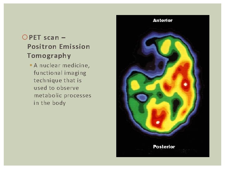  PET scan – Positron Emission Tomography § A nuclear medicine, functional imaging technique