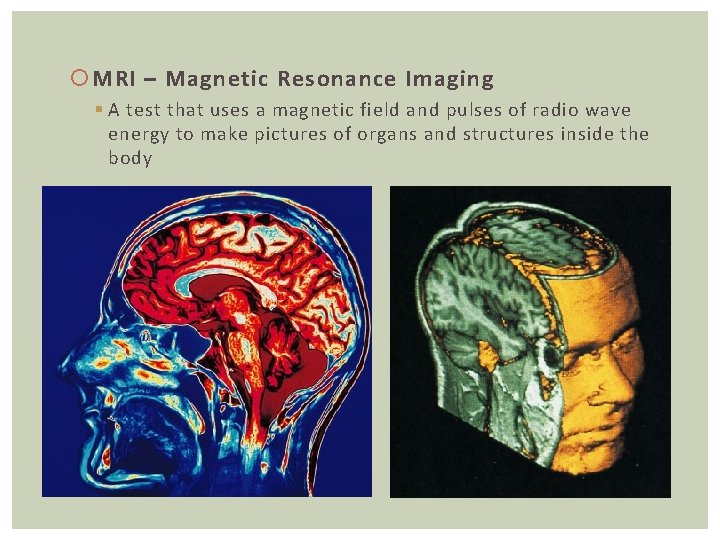  MRI – Magnetic Resonance Imaging § A test that uses a magnetic field