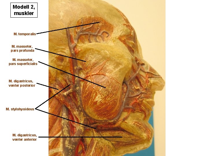 Modell 2, muskler M. temporalis M. masseter, pars profunda M. masseter, pars superficialis M.