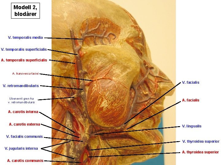 Modell 2, blodårer V. temporalis media V. temporalis superficialis A. transversa faciei V. retromandibularis