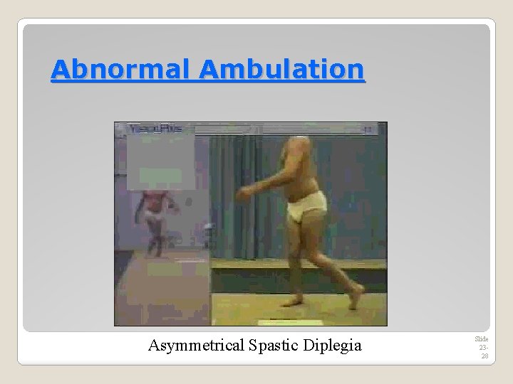 Abnormal Ambulation Asymmetrical Spastic Diplegia Slide 2328 