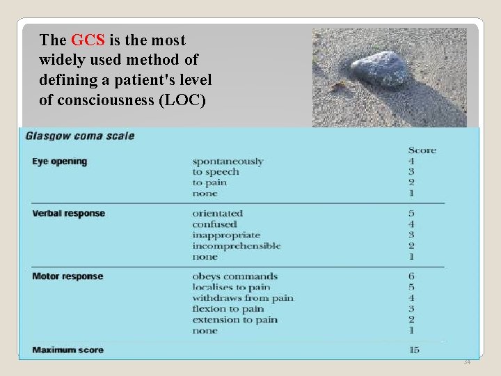 The GCS is the most widely used method of defining a patient's level of