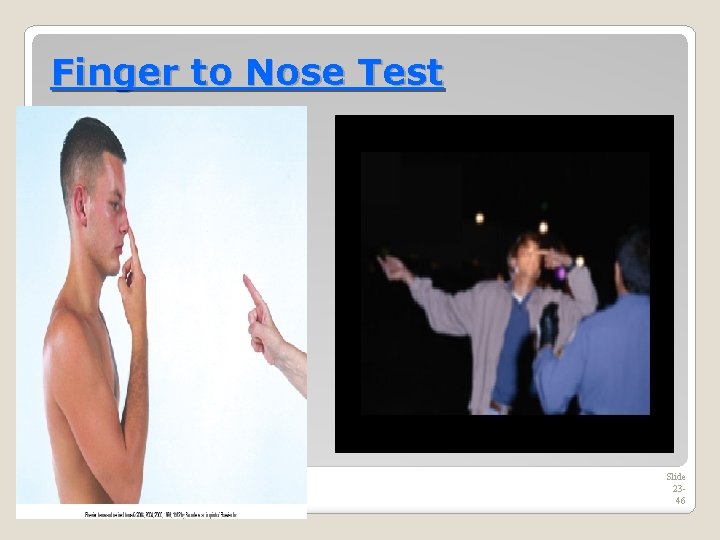 Finger to Nose Test Slide 2346 
