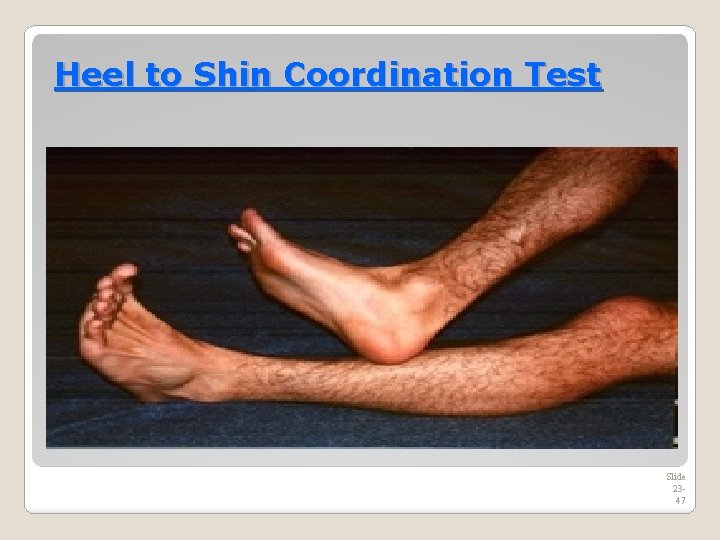 Heel to Shin Coordination Test Slide 2347 