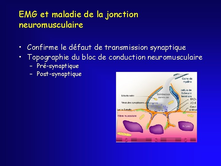 EMG et maladie de la jonction neuromusculaire • Confirme le défaut de transmission synaptique