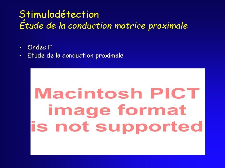 Stimulodétection Étude de la conduction motrice proximale • Ondes F • Étude de la