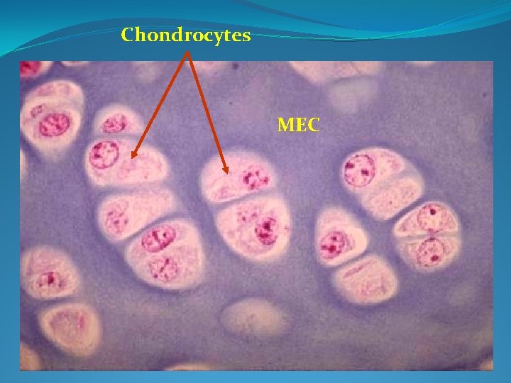 Chondrocytes MEC 