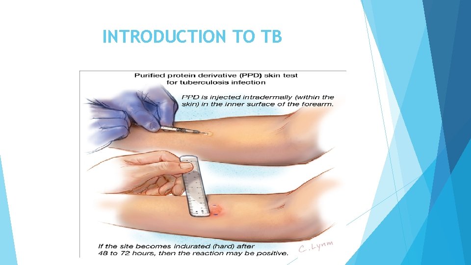 INTRODUCTION TO TB INTRODUCTION TO TB