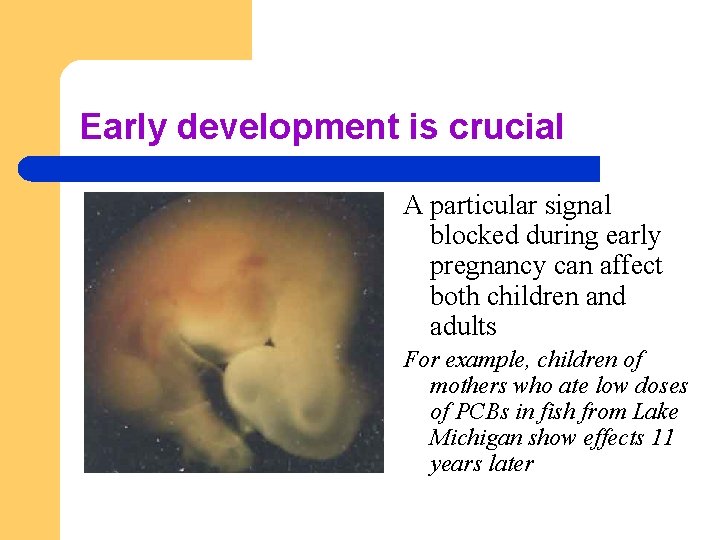 Early development is crucial A particular signal blocked during early pregnancy can affect both
