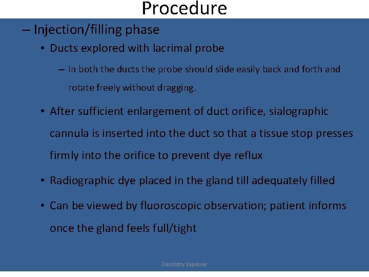 Procedure – Injection/filling phase • Ducts explored with lacrimal probe – In both the