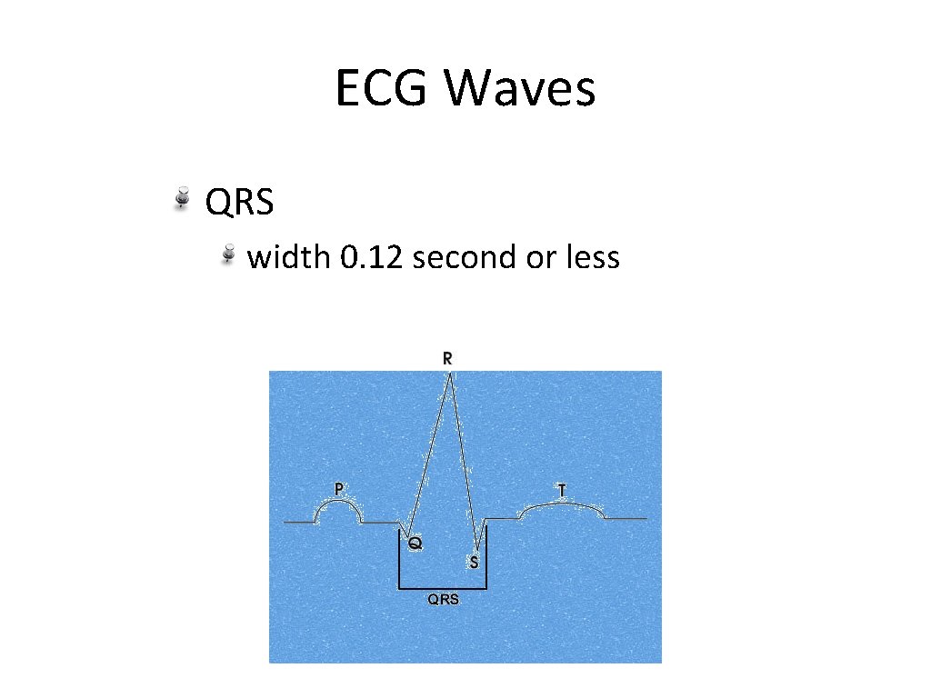 ECG Waves QRS width 0. 12 second or less 