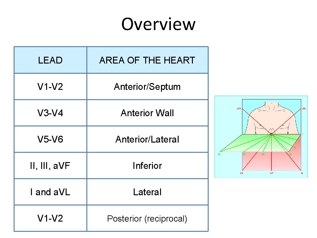 Overview LEAD AREA OF THE HEART V 1 -V 2 Anterior/Septum V 3 -V