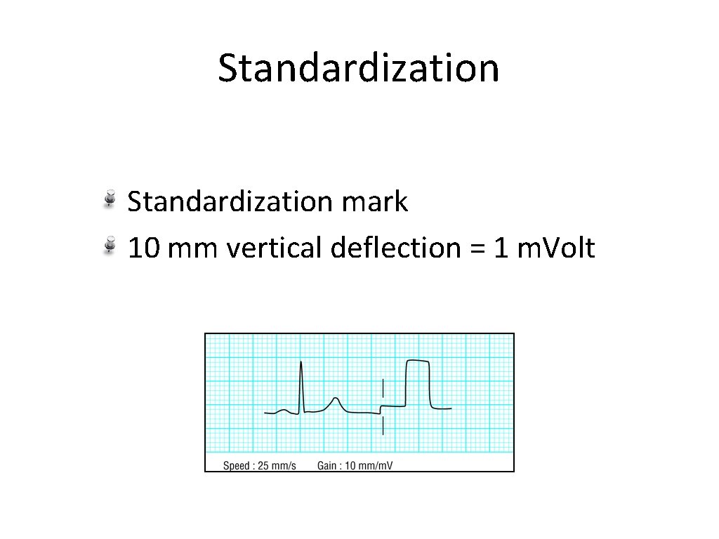 Standardization mark 10 mm vertical deflection = 1 m. Volt 