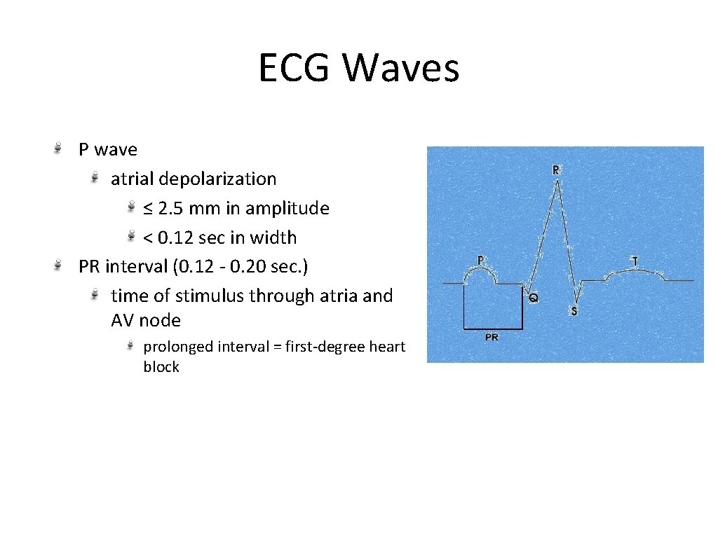 ECG Waves P wave atrial depolarization ≤ 2. 5 mm in amplitude < 0.