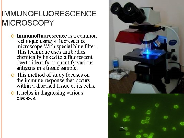 IMMUNOFLUORESCENCE MICROSCOPY Immunofluorescence is a common technique using a fluorescence microscope With special blue