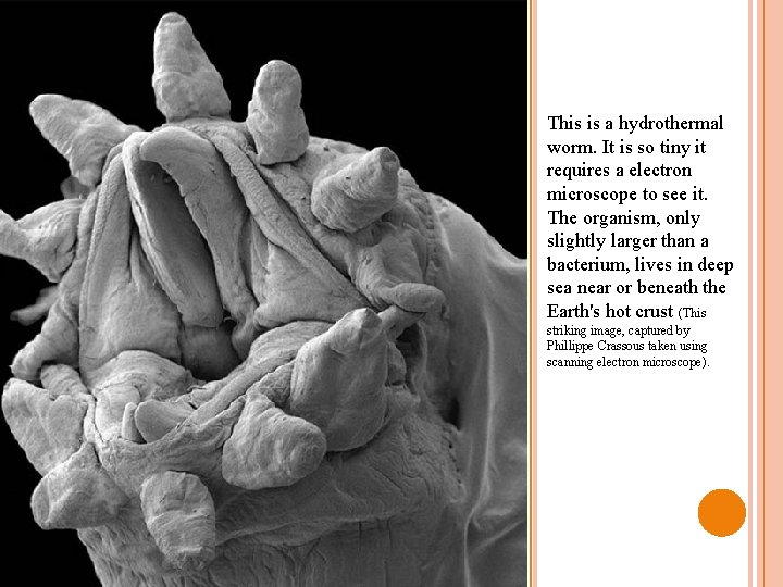 This is a hydrothermal worm. It is so tiny it requires a electron microscope