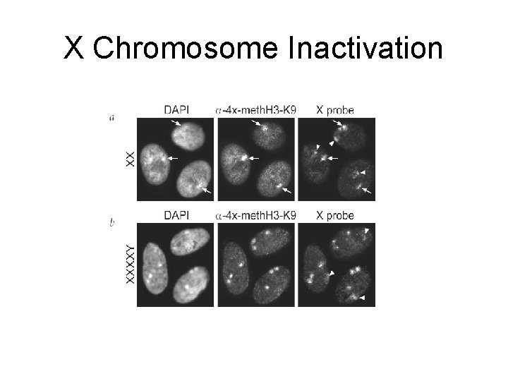 X Chromosome Inactivation 