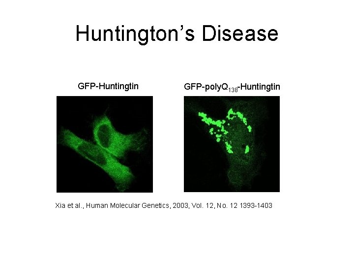 Huntington’s Disease GFP-Huntingtin GFP-poly. Q 138 -Huntingtin Xia et al. , Human Molecular Genetics,