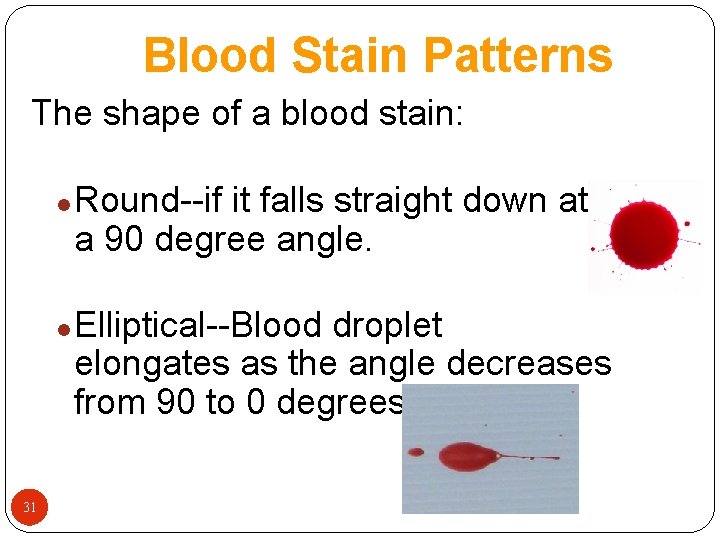 Blood Stain Patterns The shape of a blood stain: l l 31 Round--if it