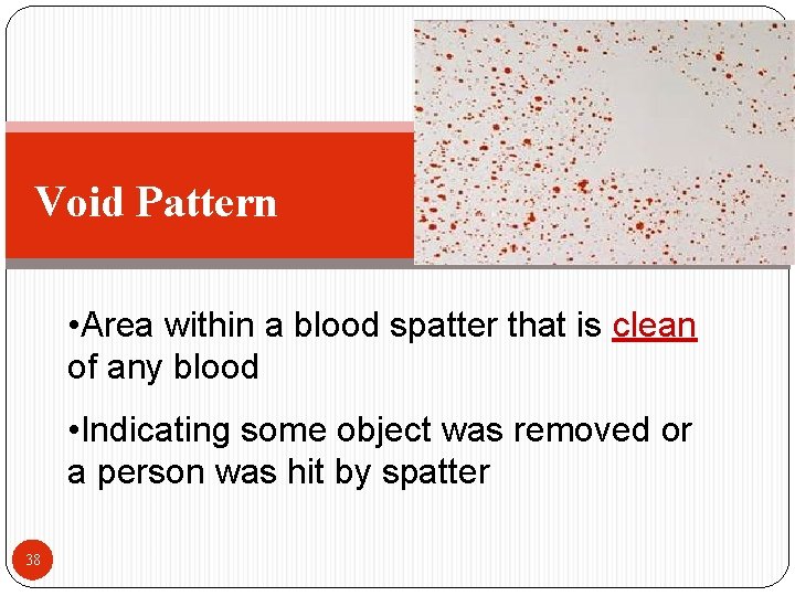 Void Pattern • Area within a blood spatter that is clean of any blood