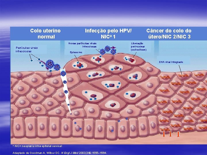 Colo uterino normal Partículas virais infecciosas Infecção pelo HPV/ NICa 1 Novas partículas virais