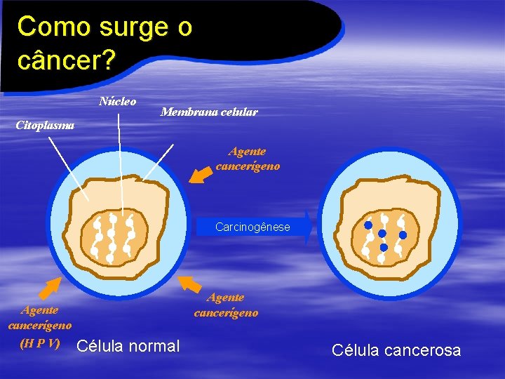 Como surge o câncer? Núcleo Citoplasma Membrana celular Agente cancerígeno Carcinogênese Agente cancerígeno (H