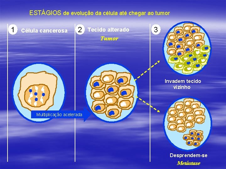 ESTÁGIOS de evolução da célula até chegar ao tumor 1 Célula cancerosa 2 Tecido