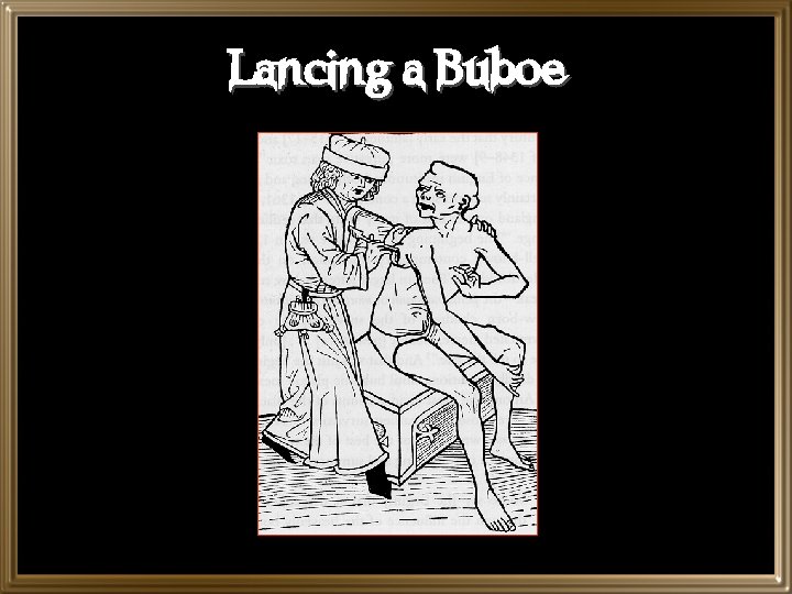 Lancing a Buboe 