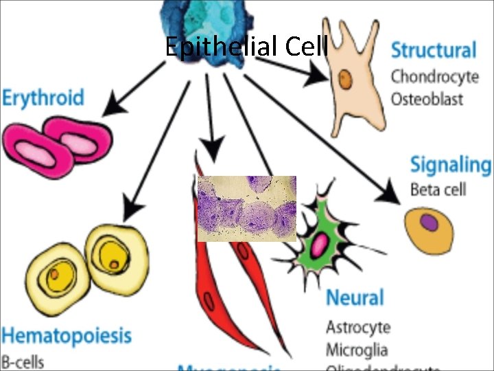 Epithelial Cell 