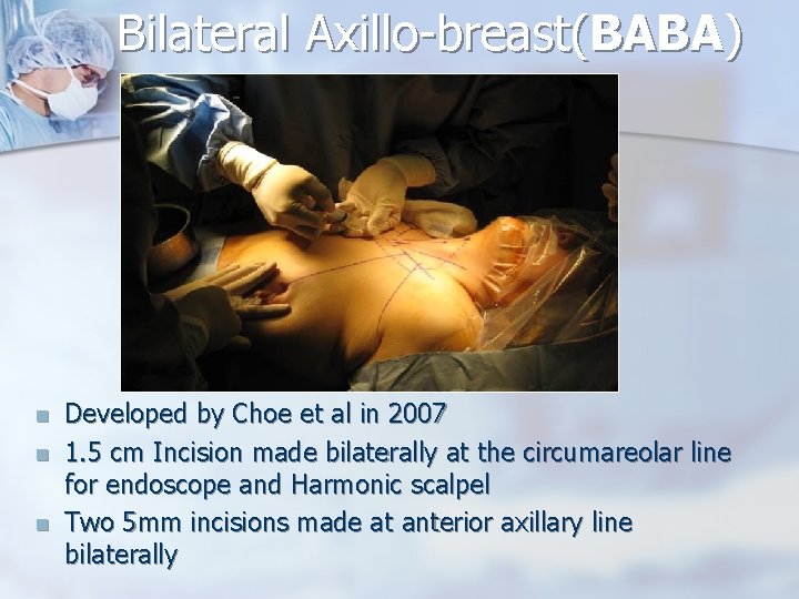 Bilateral Axillo-breast(BABA) n n n Developed by Choe et al in 2007 1. 5