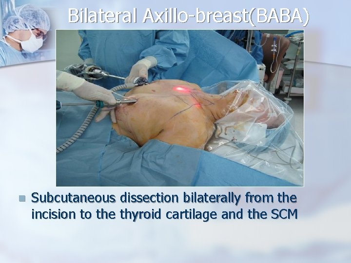 Bilateral Axillo-breast(BABA) n Subcutaneous dissection bilaterally from the incision to the thyroid cartilage and