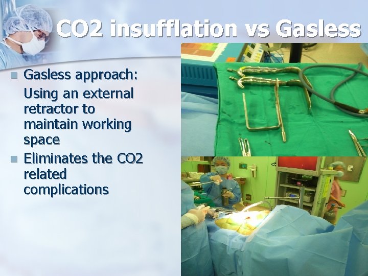 CO 2 insufflation vs Gasless n n Gasless approach: Using an external retractor to