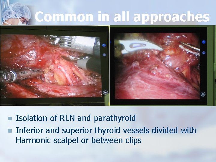 Common in all approaches n n Isolation of RLN and parathyroid Inferior and superior