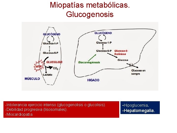 Miopatías metabólicas. Glucogenosis -Intolerancia ejercicio intenso (glucogenolisis o glucolisis). -Debilidad progresiva (lisosomales). -Miocardiopatía. -Hipoglucemia.