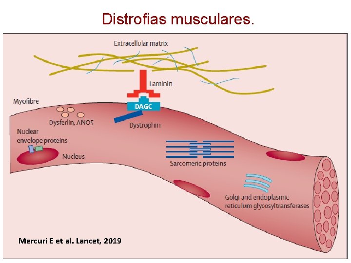 Distrofias musculares. Mercuri E et al. Lancet, 2019 