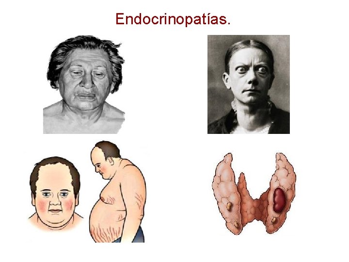 Endocrinopatías. 