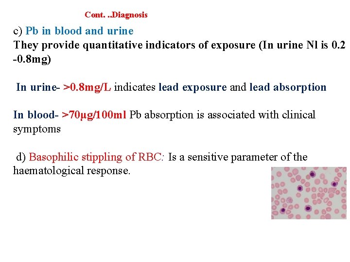 Cont. . . Diagnosis c) Pb in blood and urine They provide quantitative indicators