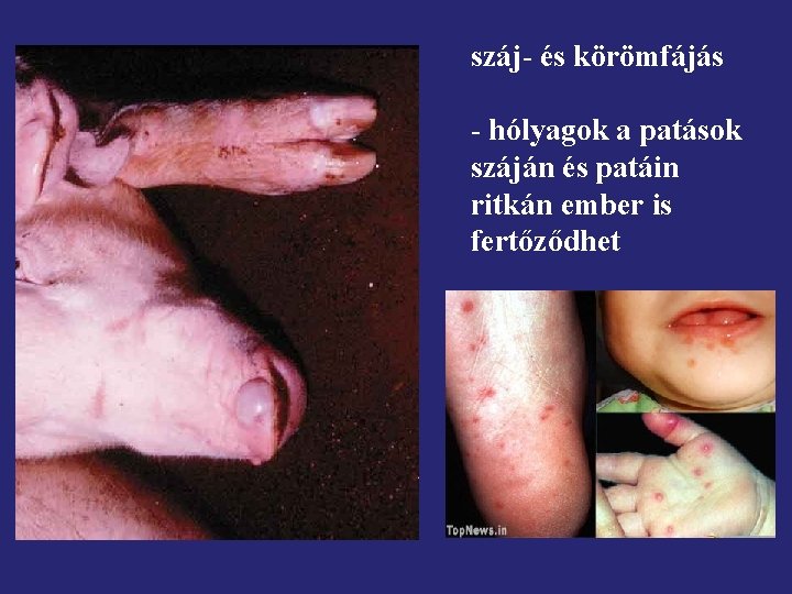 száj- és körömfájás - hólyagok a patások száján és patáin ritkán ember is fertőződhet