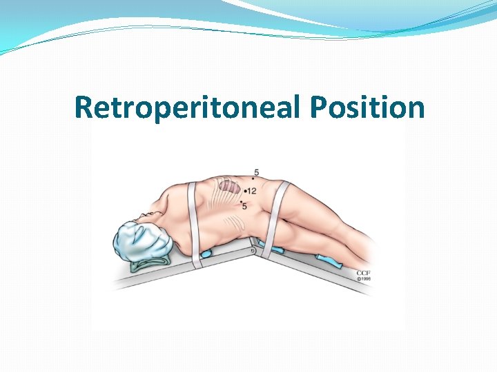 Retroperitoneal Position 