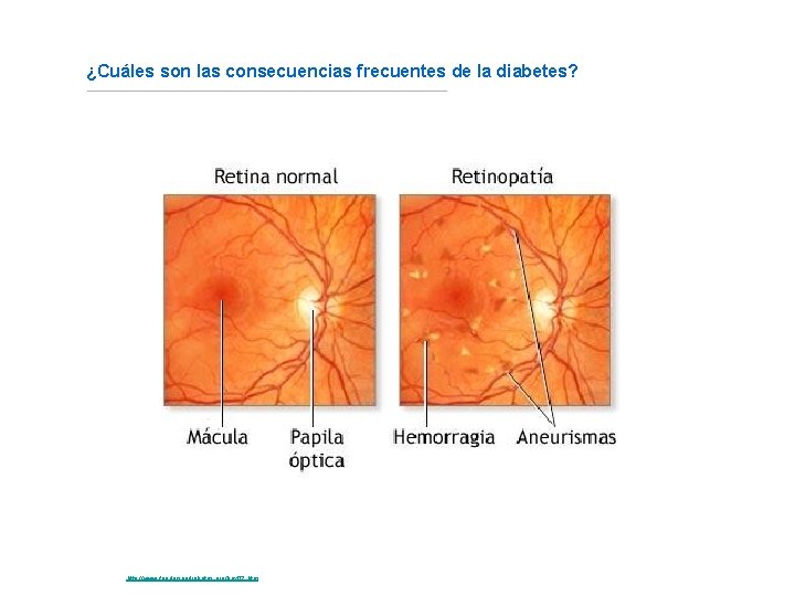 ¿Cuáles son las consecuencias frecuentes de la diabetes? Fuente: http: //www. fundaciondiabetes. org/box 02.