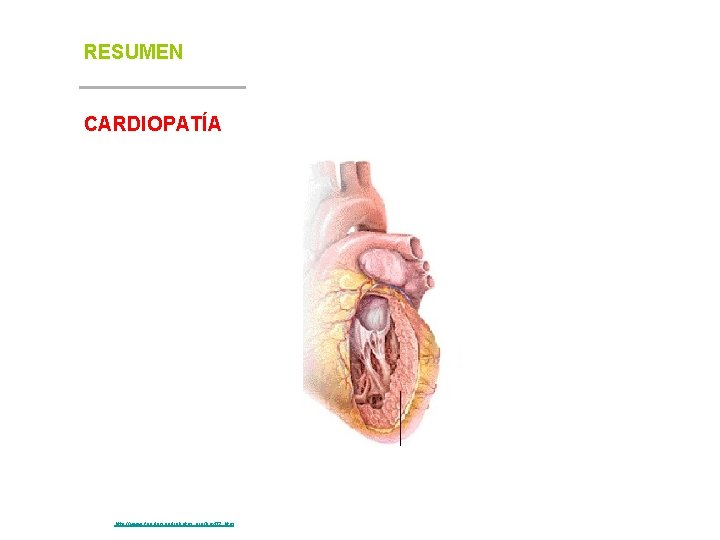 RESUMEN CARDIOPATÍA Fuente: http: //www. fundaciondiabetes. org/box 02. htm 