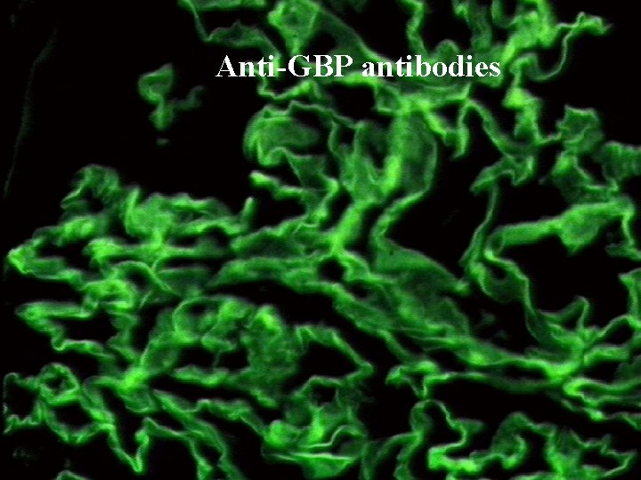 Anti-GBP antibodies Anti-GBP antibodies